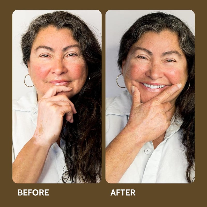 Fake Bake Vitiligo Vanquish Cosmetic Camouflage Kit - Liquid Concealer for Skin Depigmentation - Image 4
